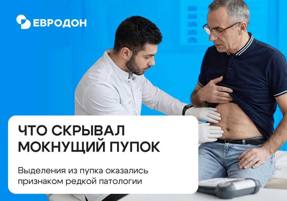 👉 В клинику Евродон обратился мужчина, который стал замечать у себя необычные симптомы...