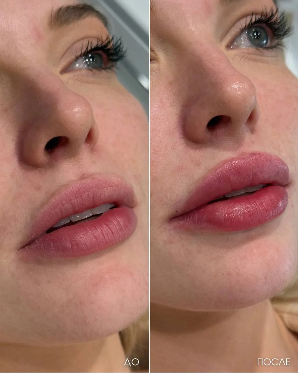 Те самые чувственные губы: выразительные, но без лишнего объема 💋