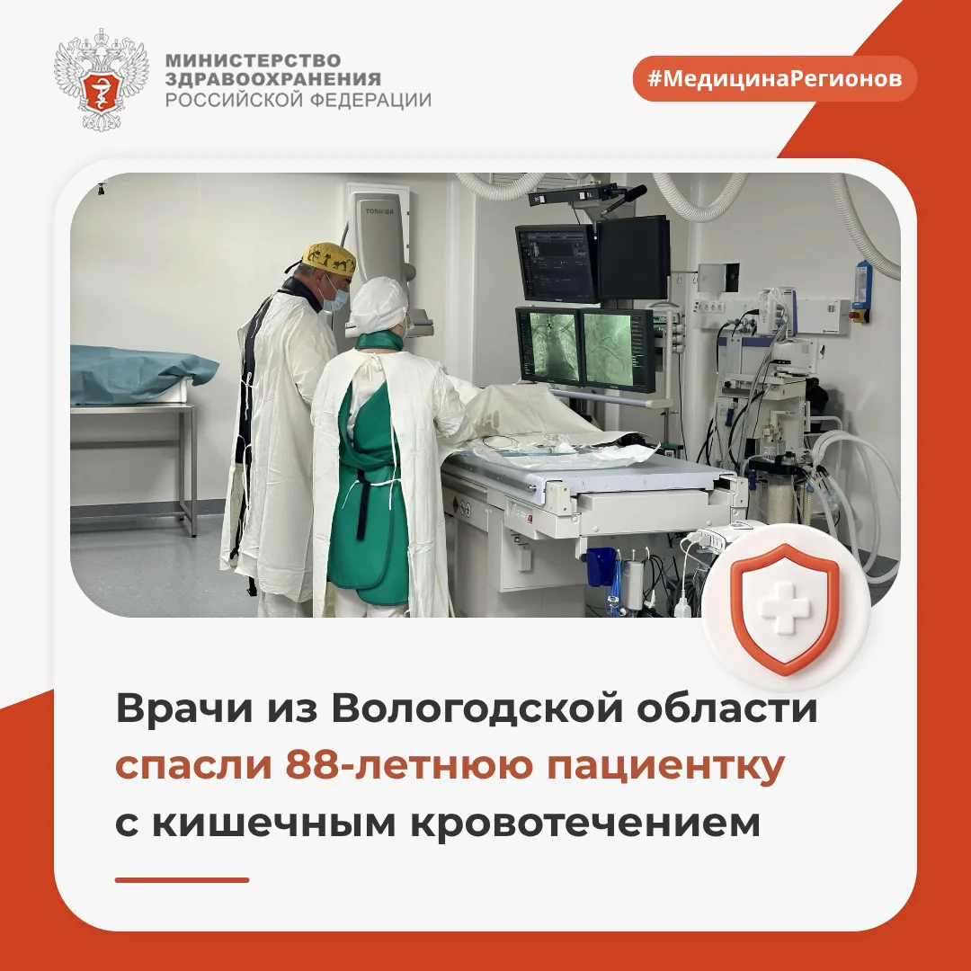 👨‍⚕️ Врачи из Вологодской области спасли 88-летнюю пациентку с кишечным кровотечением
