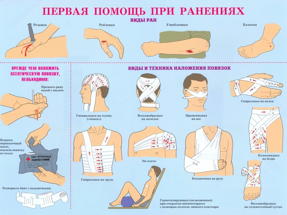 Первая помощь при ранениях.
Быстро остановите кровотечение прямым давлением на рану, промойте её чис