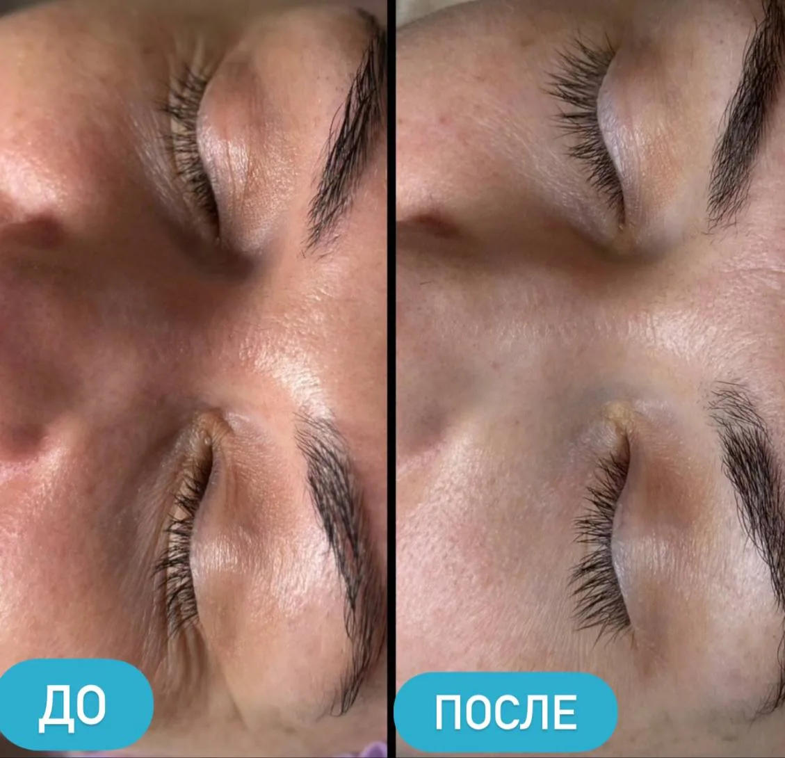 Результат говорит сам за себя 💯