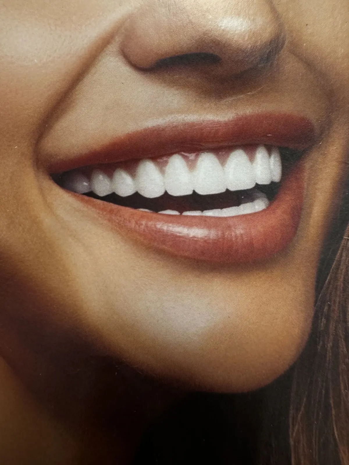 Имплантация Зубов 🦷 АКЦИЯ❗️
Стоимость имплантата Южная Корея Dentium  29’500 рублей✨
Консультация в