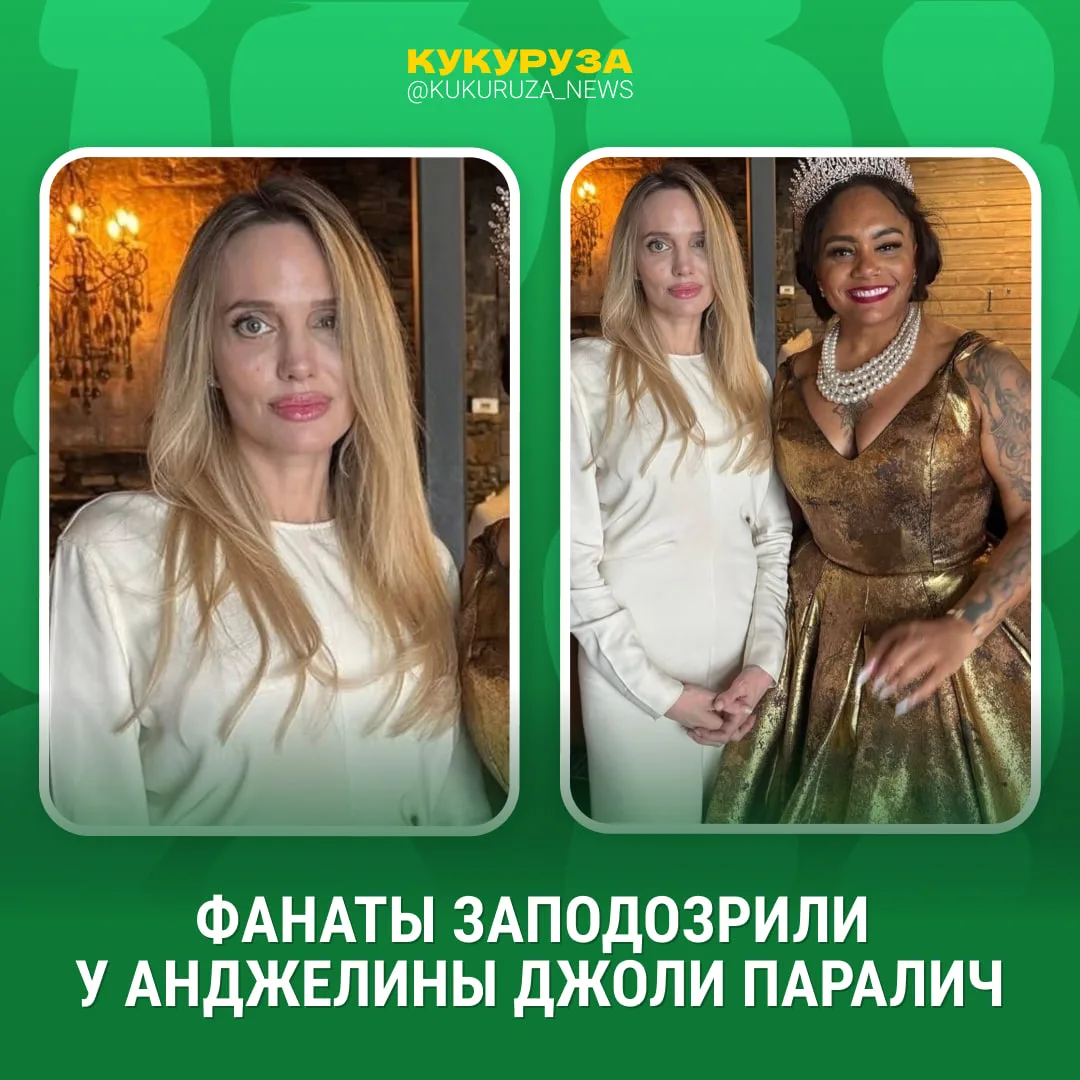 Не могут отстать от внешности Анджелины Джоли фанаты. Сейчас ходят слухи, что у артистки паралич лиц