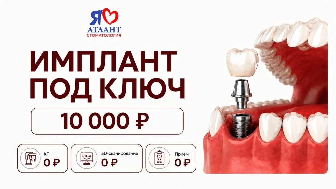 Имплант под ключ 10 000₽ в Тюмени