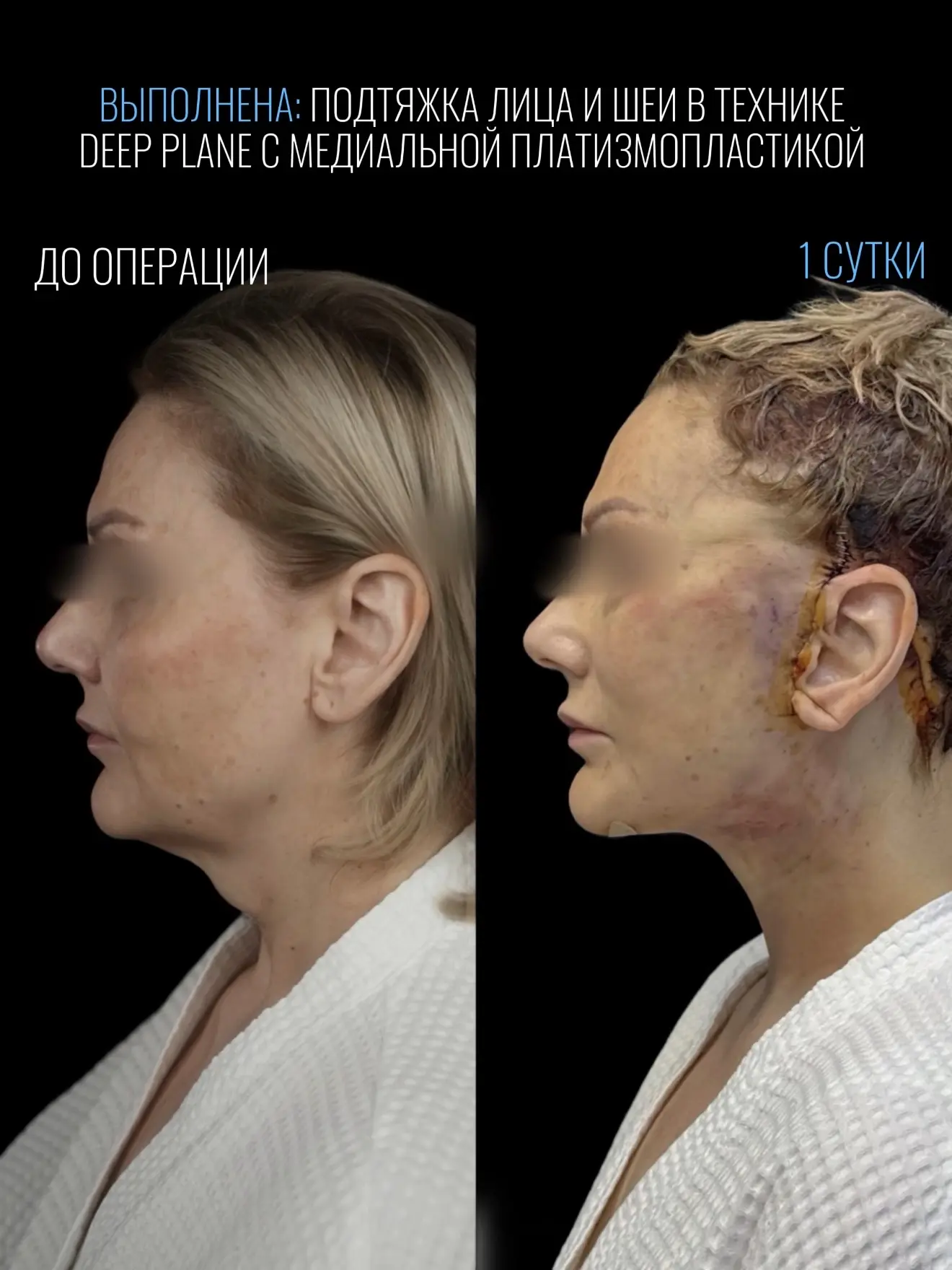 О СТРАХАХ ПАЦИЕНТОВ👇🏻