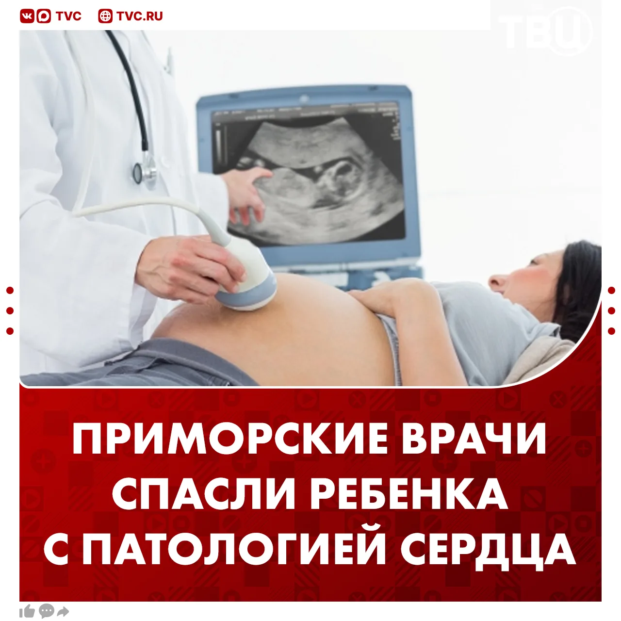 Врачи спасли еще не родившегося ребенка с тяжелой сердечной патологией в Приморье