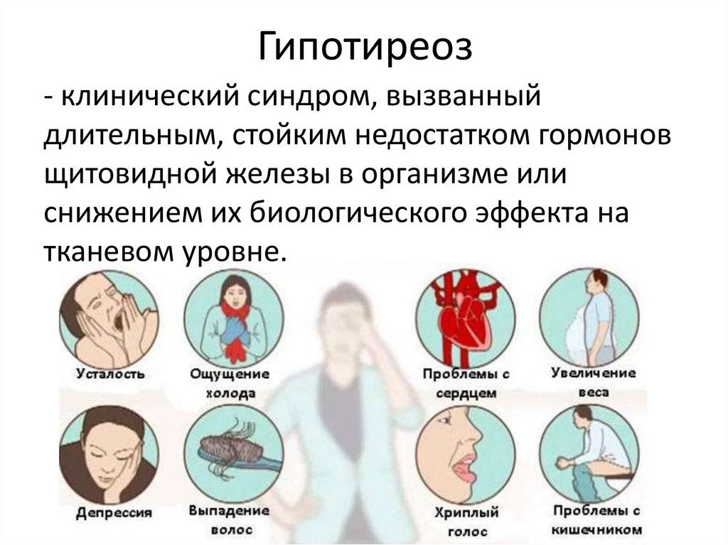 Гипотиреоз: причины, симптомы и риски