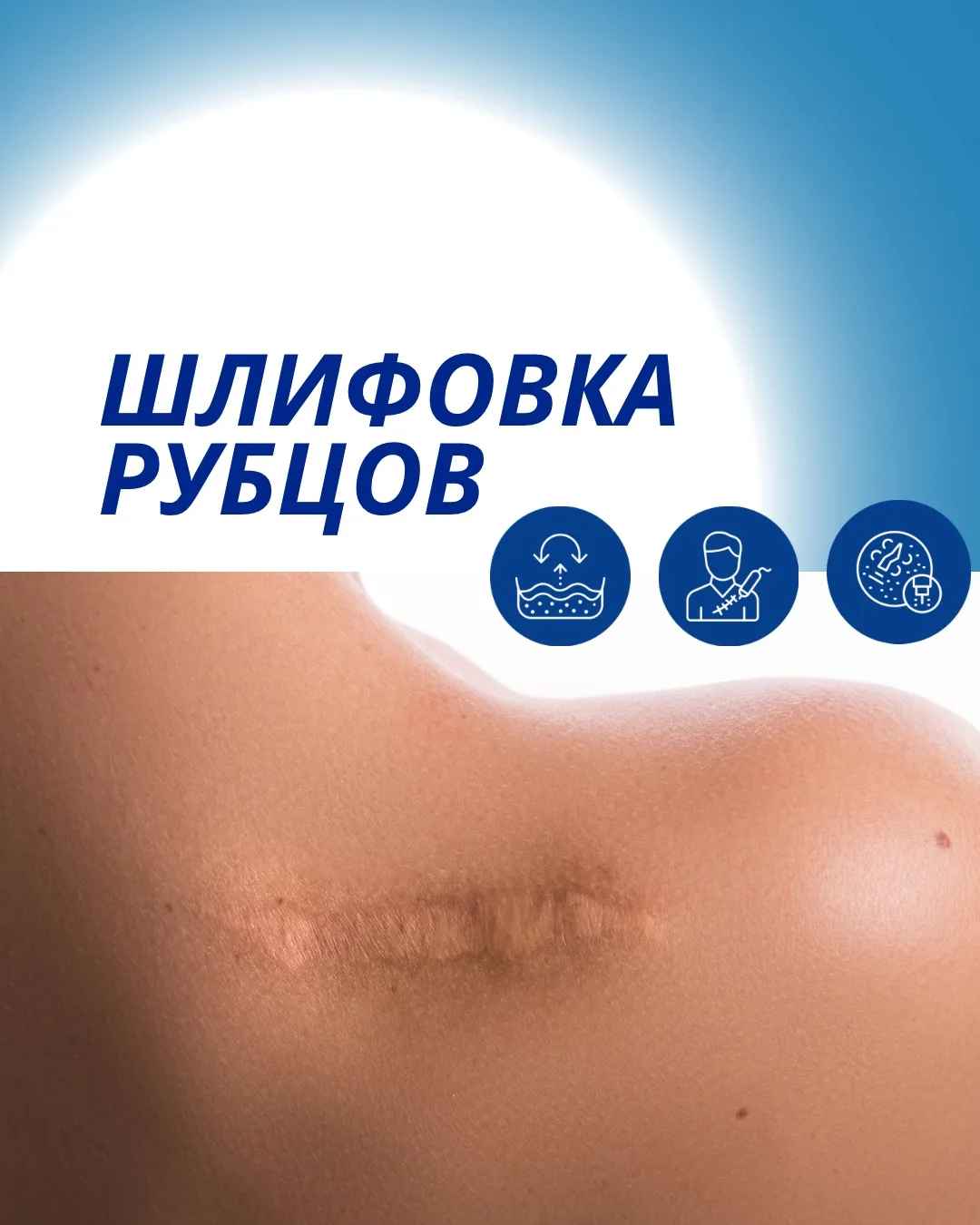 Рубцы — не приговор для вашей кожи