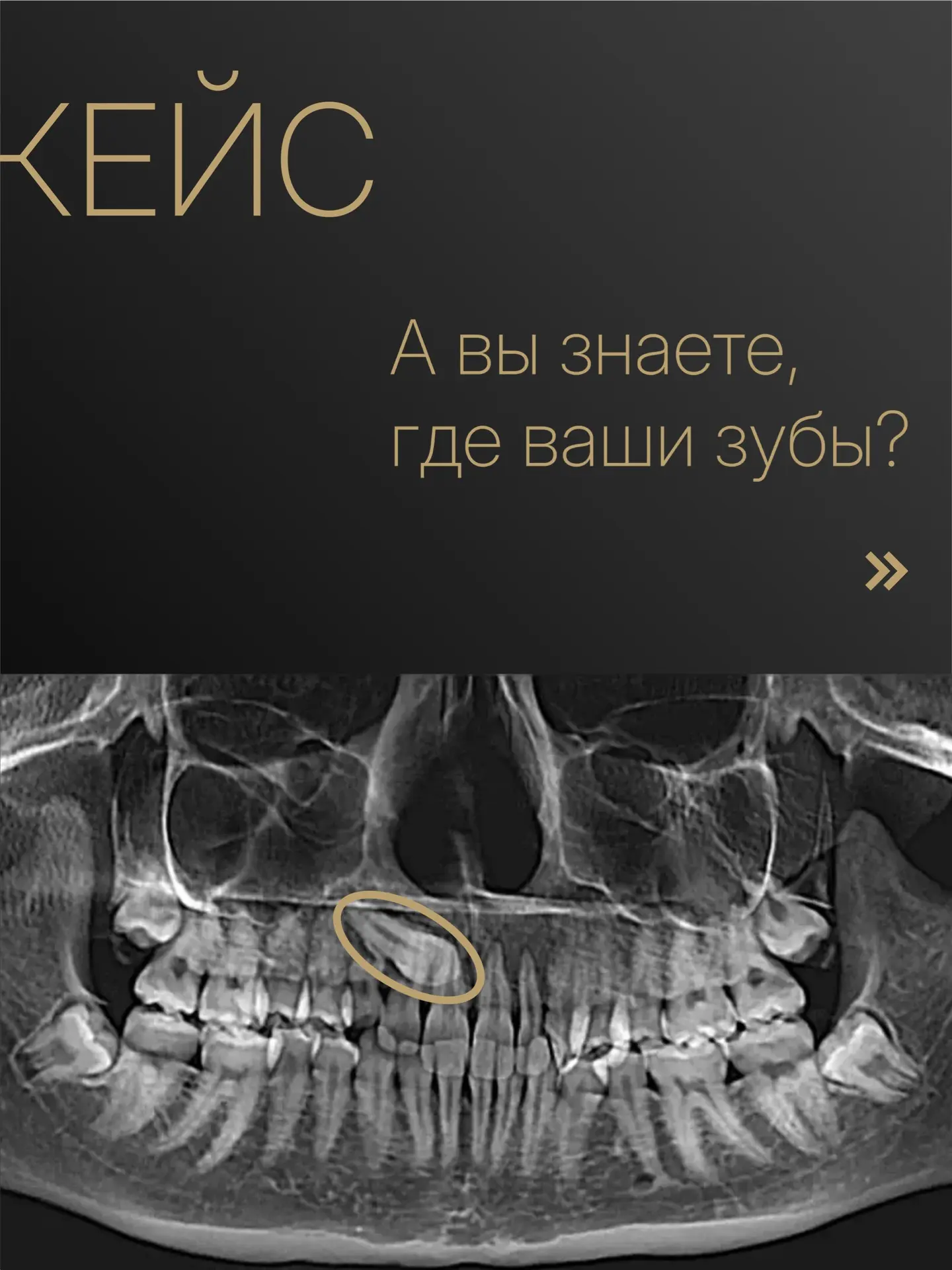 Точно знаете, где ваши зубы?