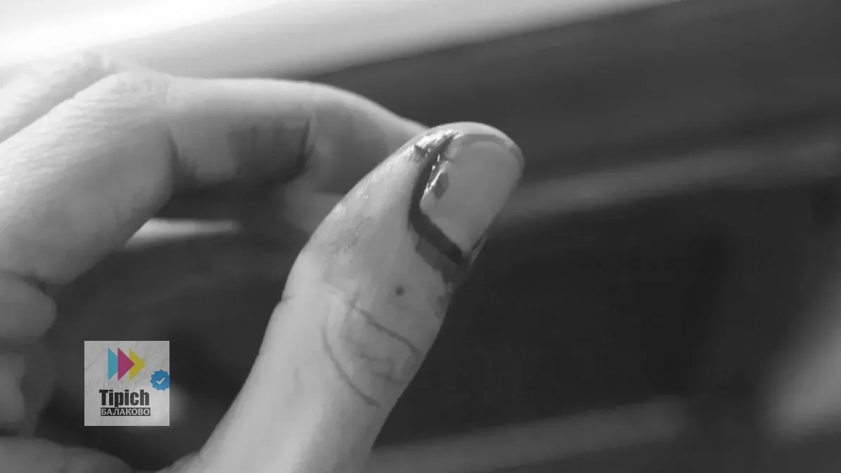 😱 «Просто обрезала кусты»: в Балаково женщина лишилась части пальца из‑за электросекатора