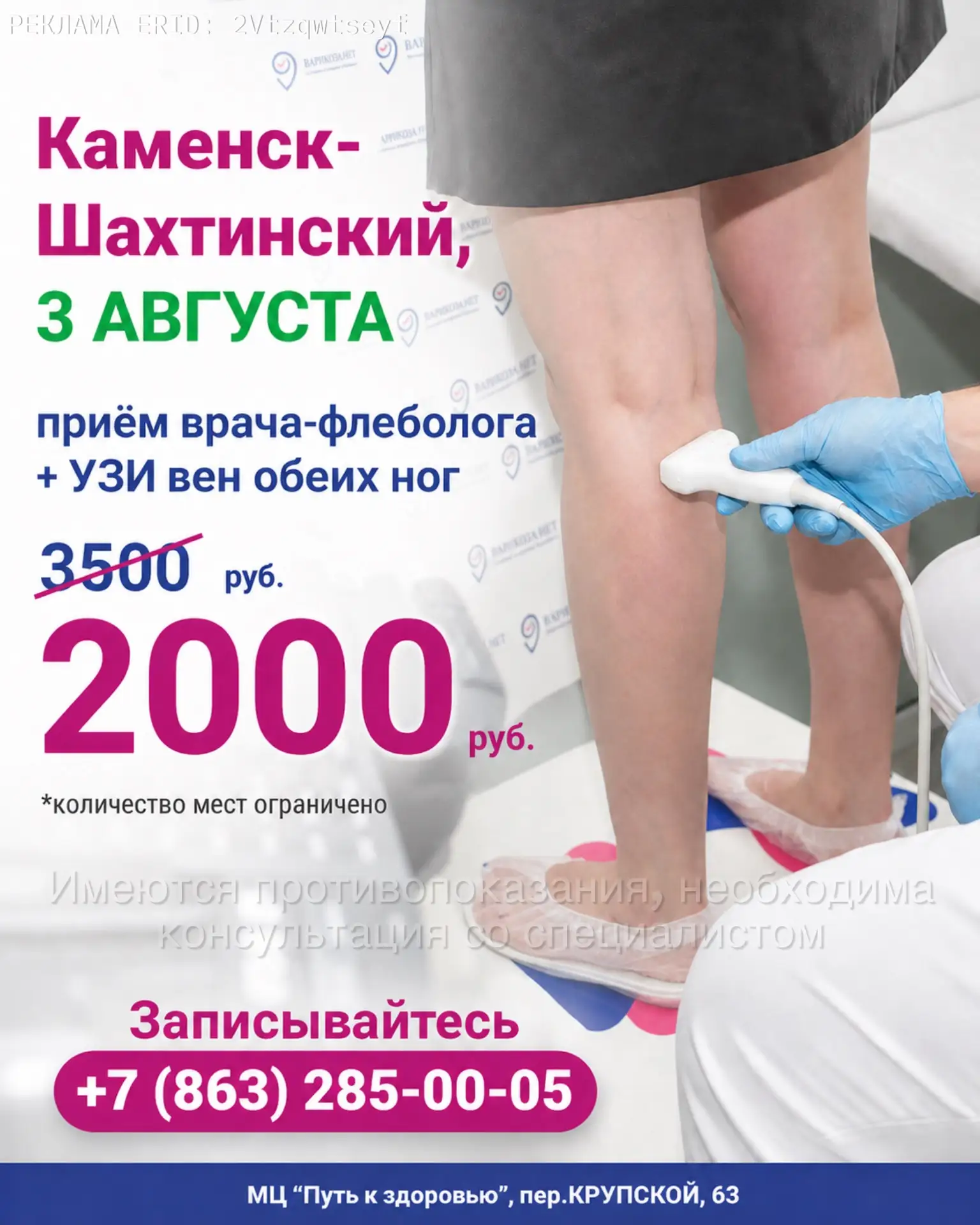 Акция! Приём врача-флеболога + УЗИ вен обеих ног всего за 2000 рублей! (вместо 3500р) 

 ❗️Только 3 