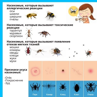 Укус жалящих насекомых