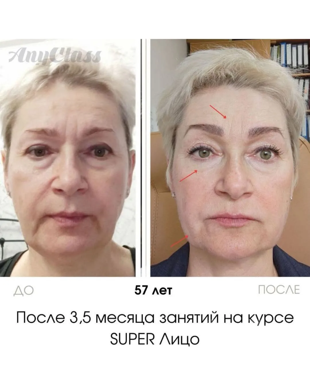 Изображение 1 к публикации «Гимнастика для лица»