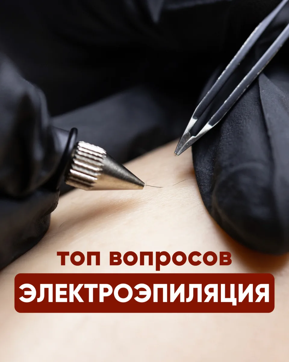 Топ вопросов про электроэпиляцию👇