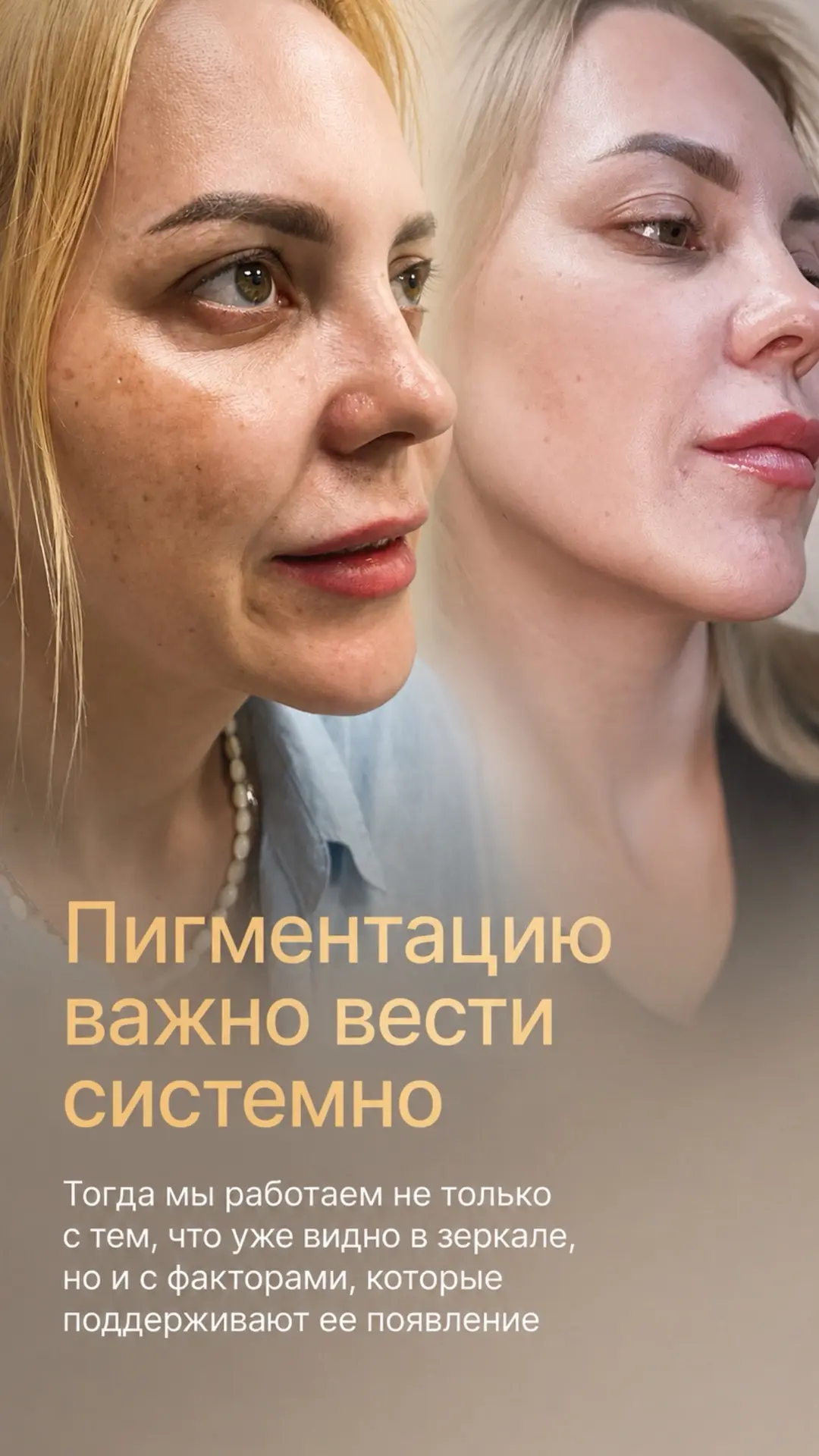 Пигментация после лета,