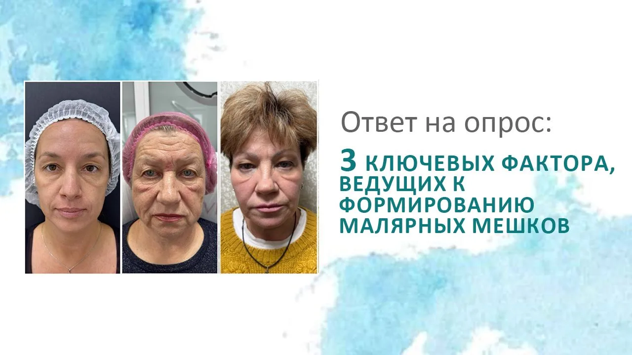 Недавно просила вас: назвать 3 ключевых фактора, ведущих к формированию малярных мешков.
