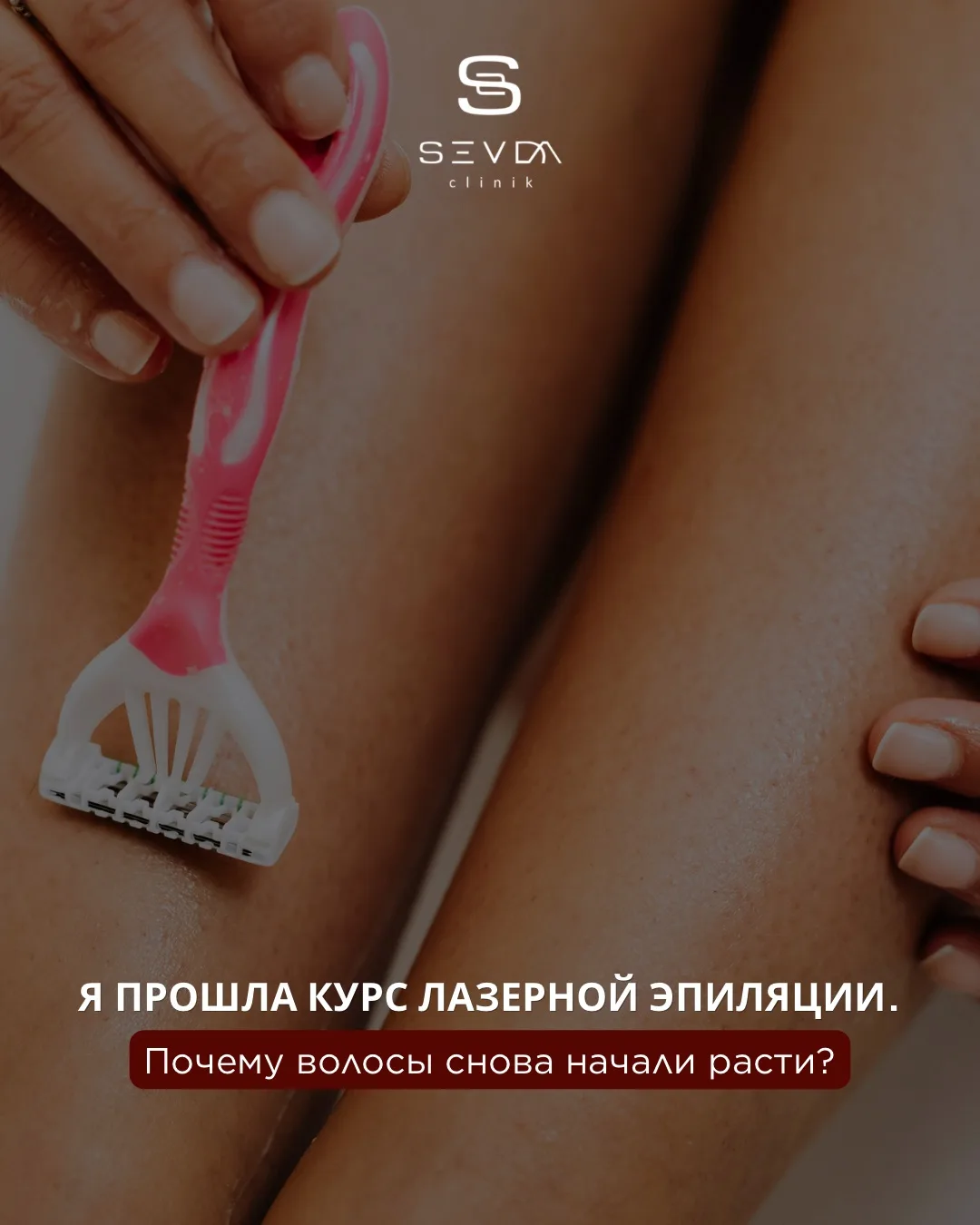«Я прошла курс лазерной эпиляции. Почему волосы снова начали расти?»