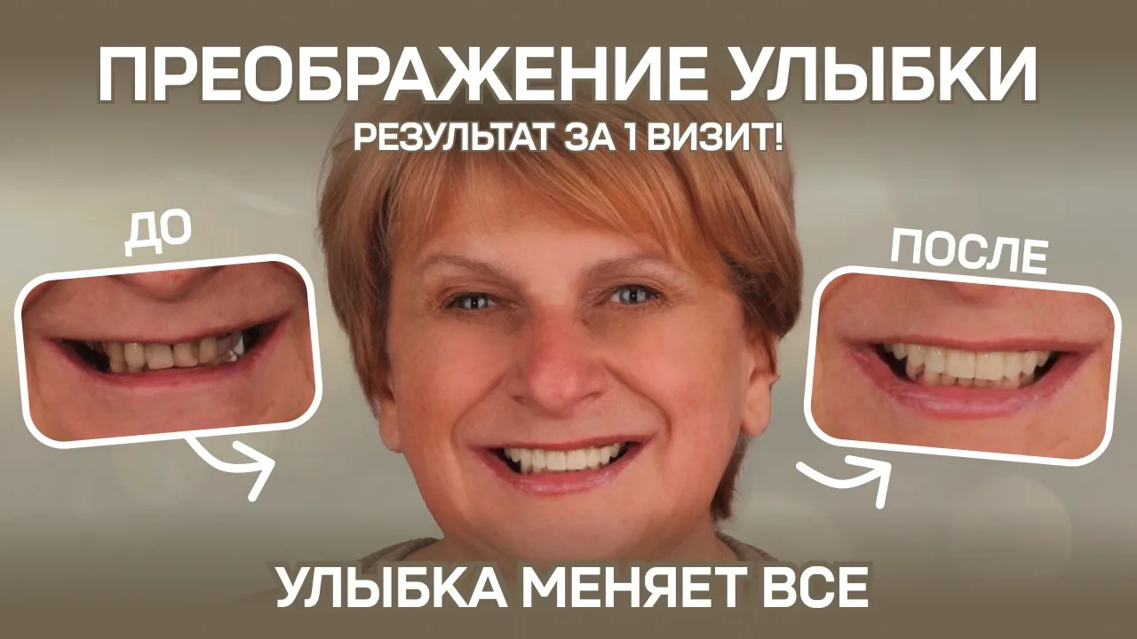 За сложными клиническими случаями всегда стоит не только эстетическая проблема, но и на...