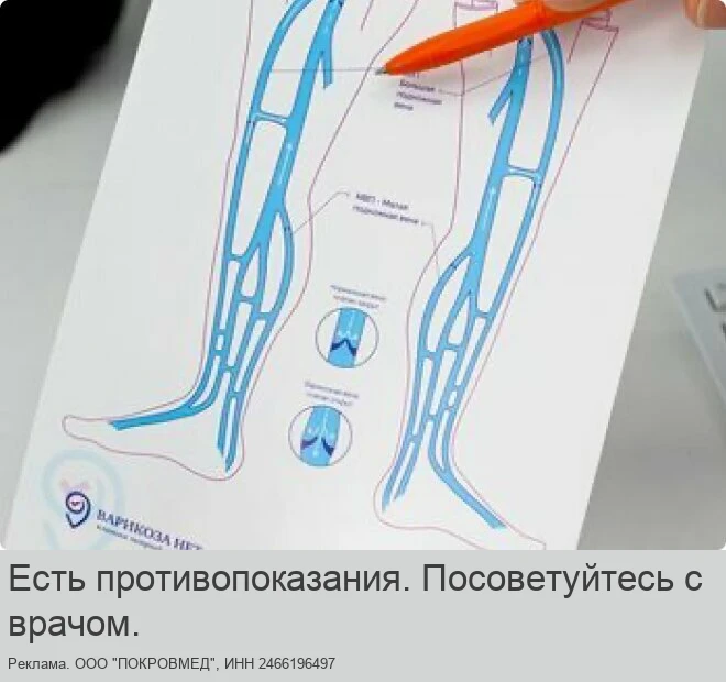 Приём флеболога с УЗИ вен ног — 690 ₽
