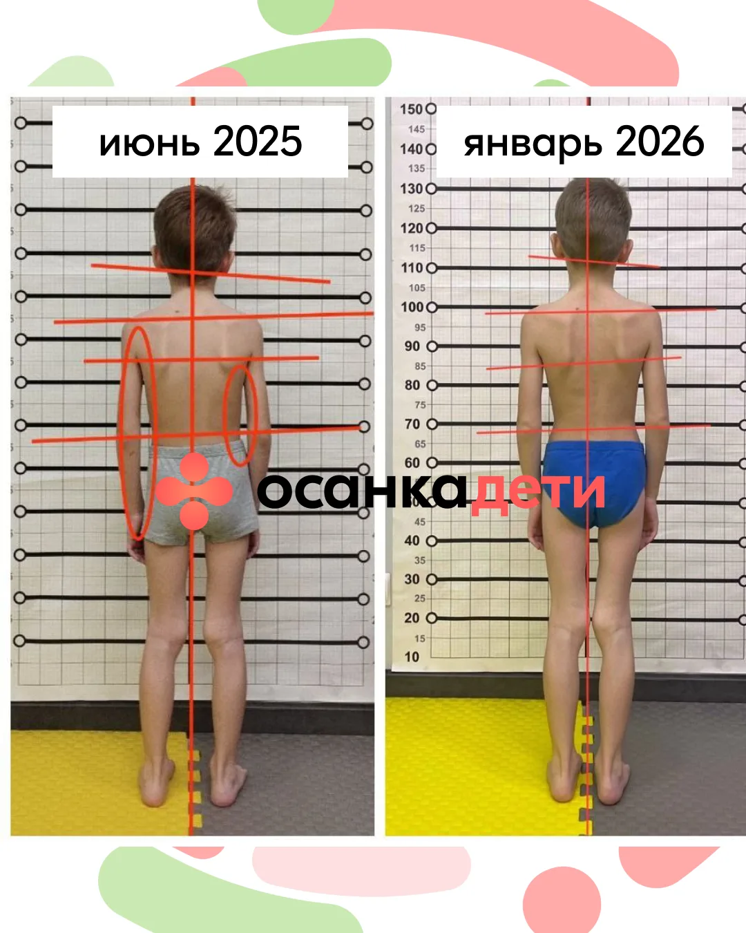 За полгода сын вырос на 8 см. Что спасло его осанку👇  Рассказываю на своем примере, почему период ак