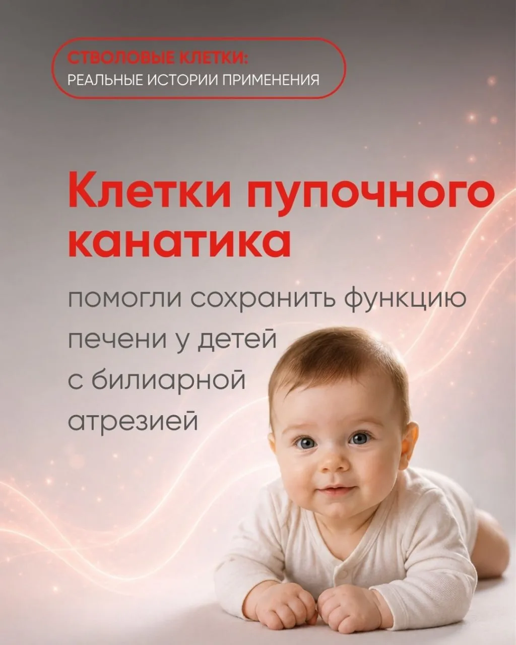 Клетки пупочного канатика помогли сохранить функцию печени у детей с билиарной атрезией