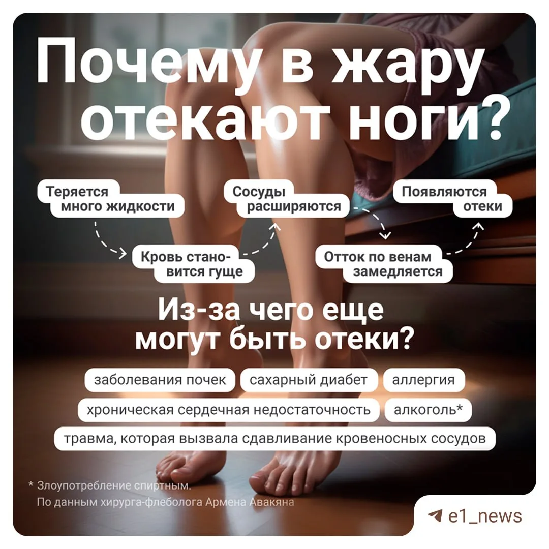 Жаркая погода — это не только солнце и отдых, но и частые отеки ног 🥵  Тяжесть и дискомфорт могут пр