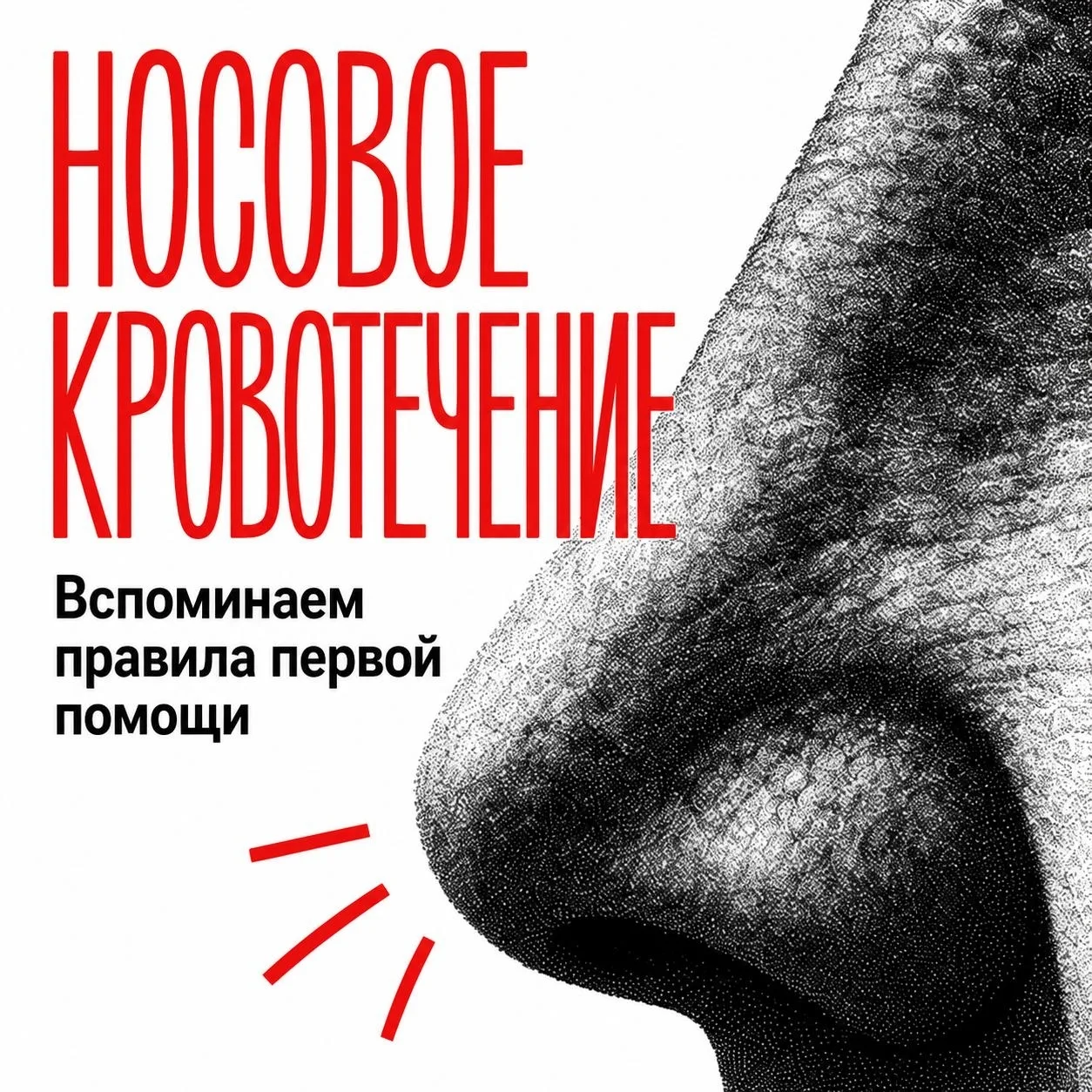 Носовое кровотечение — ситуация знакомая, а вот советы о первой помощи окутаны мифами.