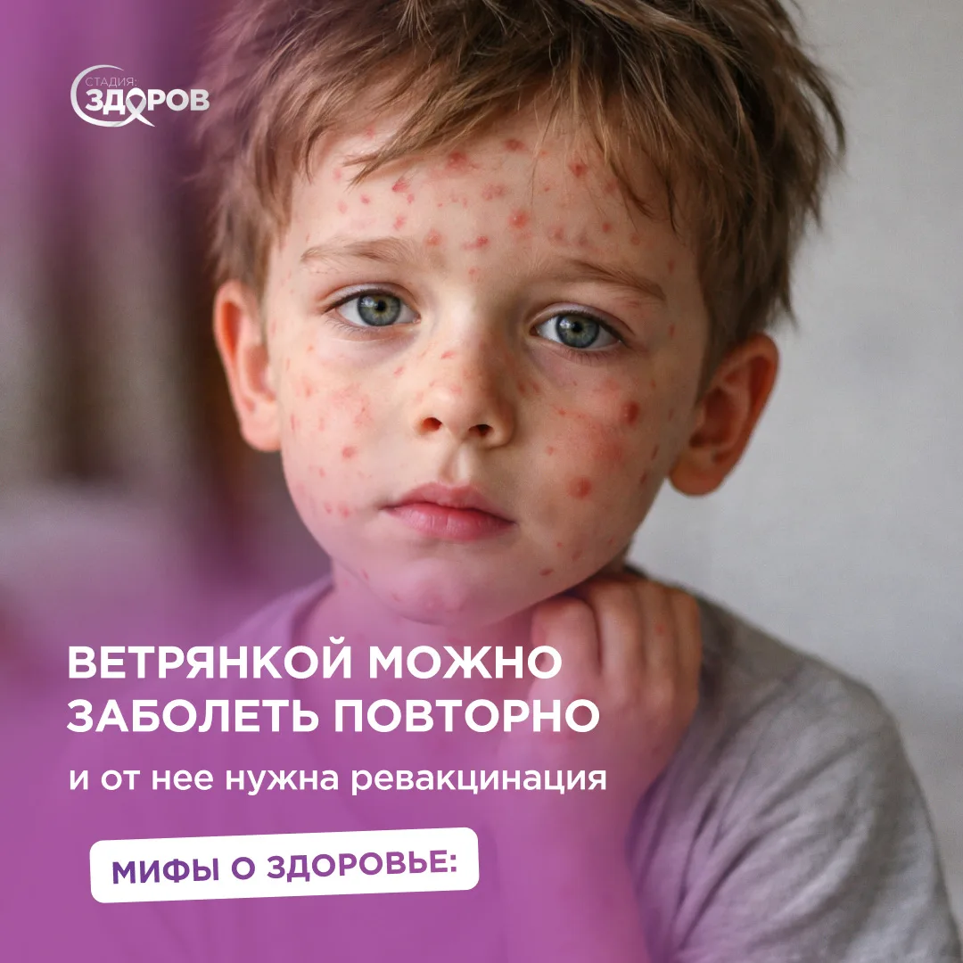 Ветрянка — детская болезнь?🦠