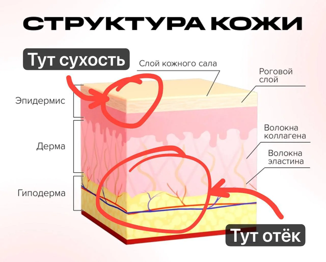 Ситуация, когда на коже одновременно и отёки, и сухость — не редкая. Потому что вода в этих случаях 