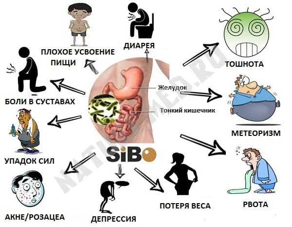 СИБР и гормоны: почему вздутие, акне и  ПМС — часто «идут» вместе.