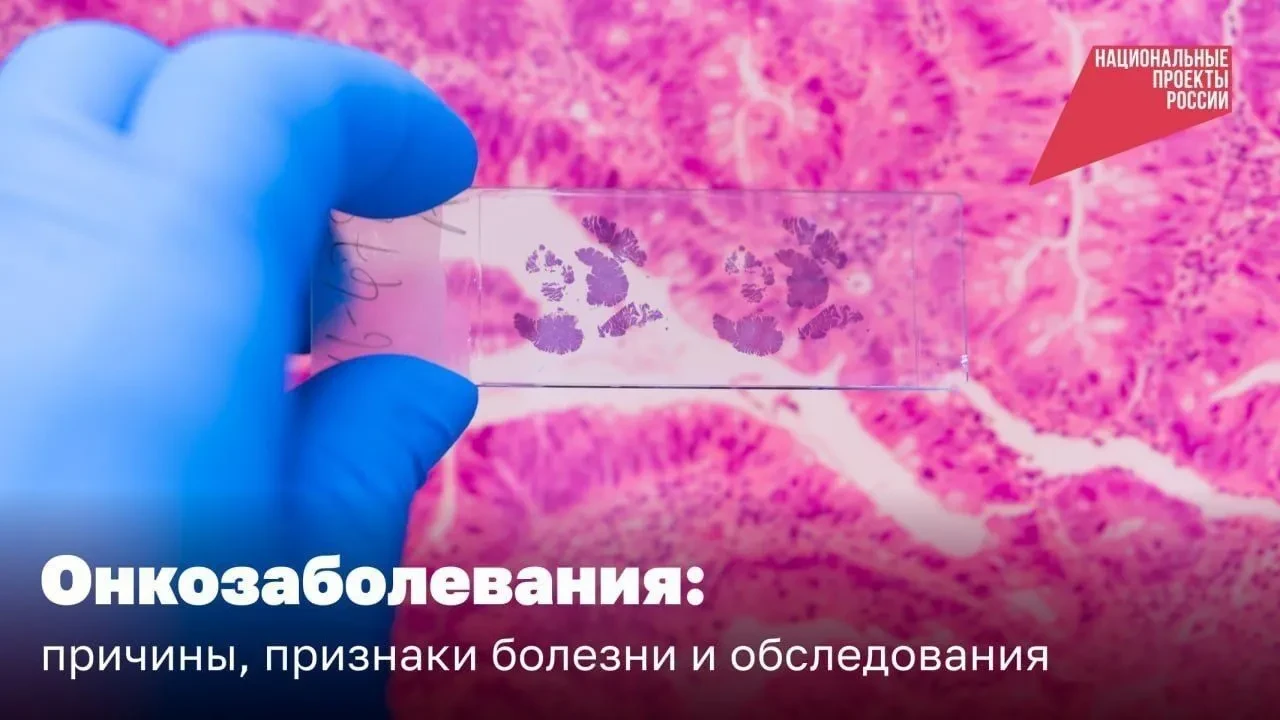 🏥 Борьба с онкологическими заболеваниями в рамках реализации национального проекта "Продолжительная