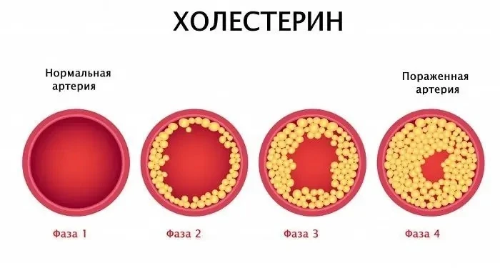 Невероятный рецепт для снижения уровня холестерина

▪️Взять 3 средних лимона, промыть и просушить
▪️