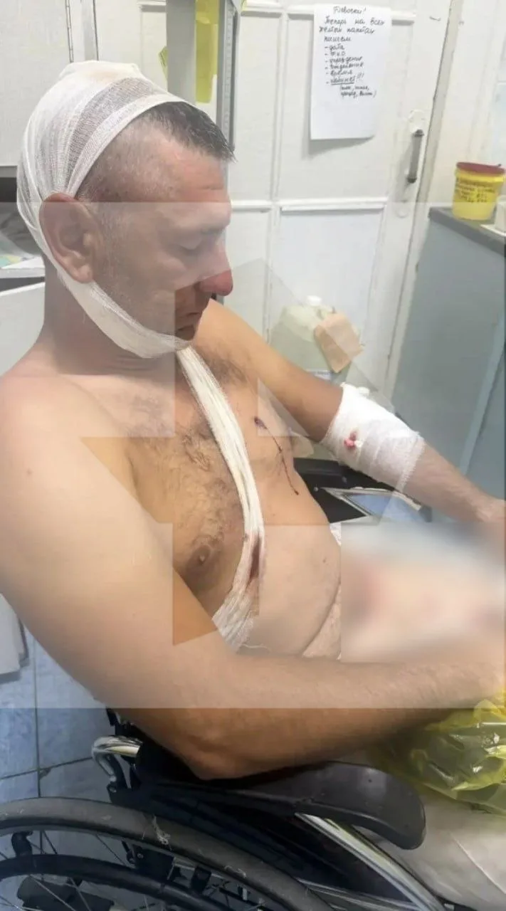 Полиция возбудила уголовное дело после стрельбы в Мирном — по данным МВД, в мужчину стр...