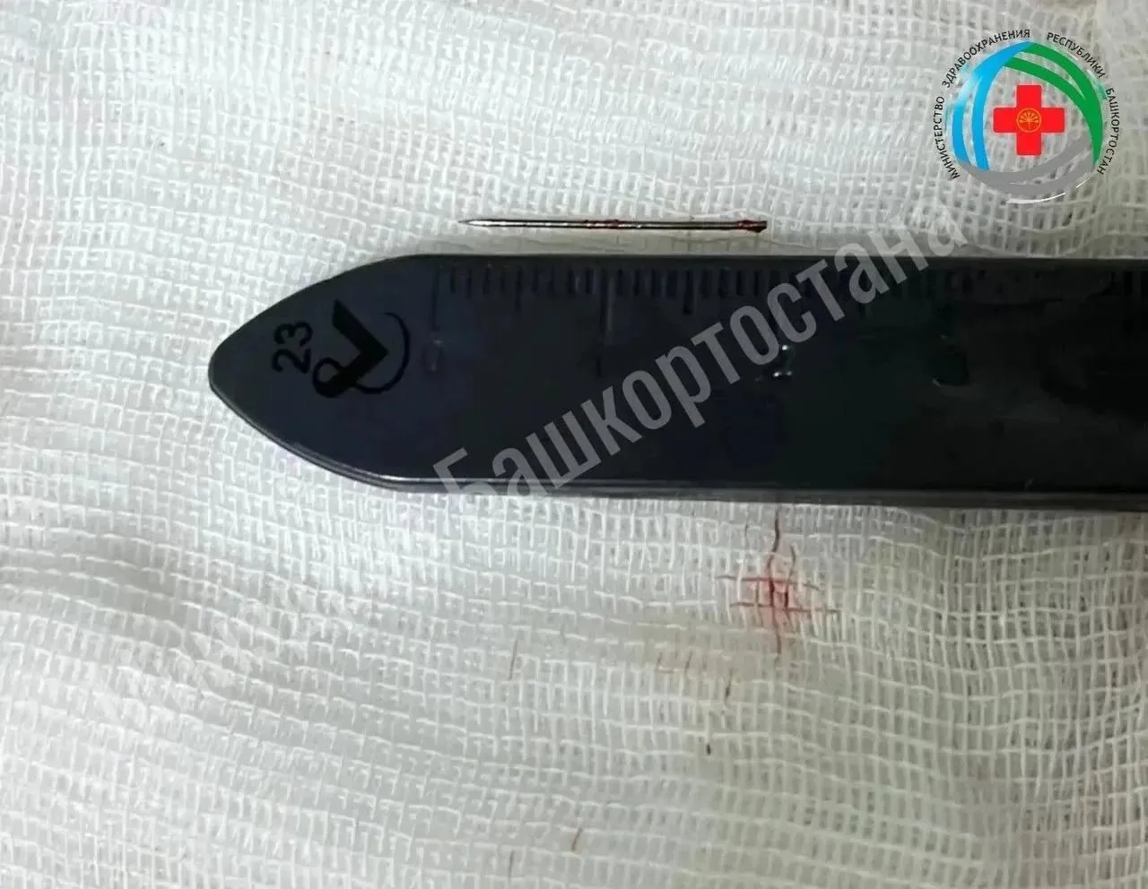 В Ишимбае медики извлекли из стопы полуторагодовалого ребёнка иглу длиной два сантиметра.

Родители 