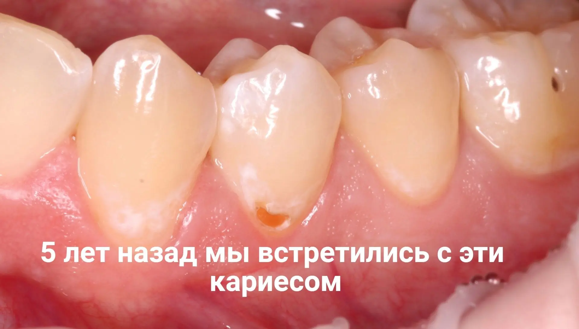 ⚡️Делюсь пятилетним реколлом. Знаю, что найдете огрехи, рад буду обсудить. А если понра...