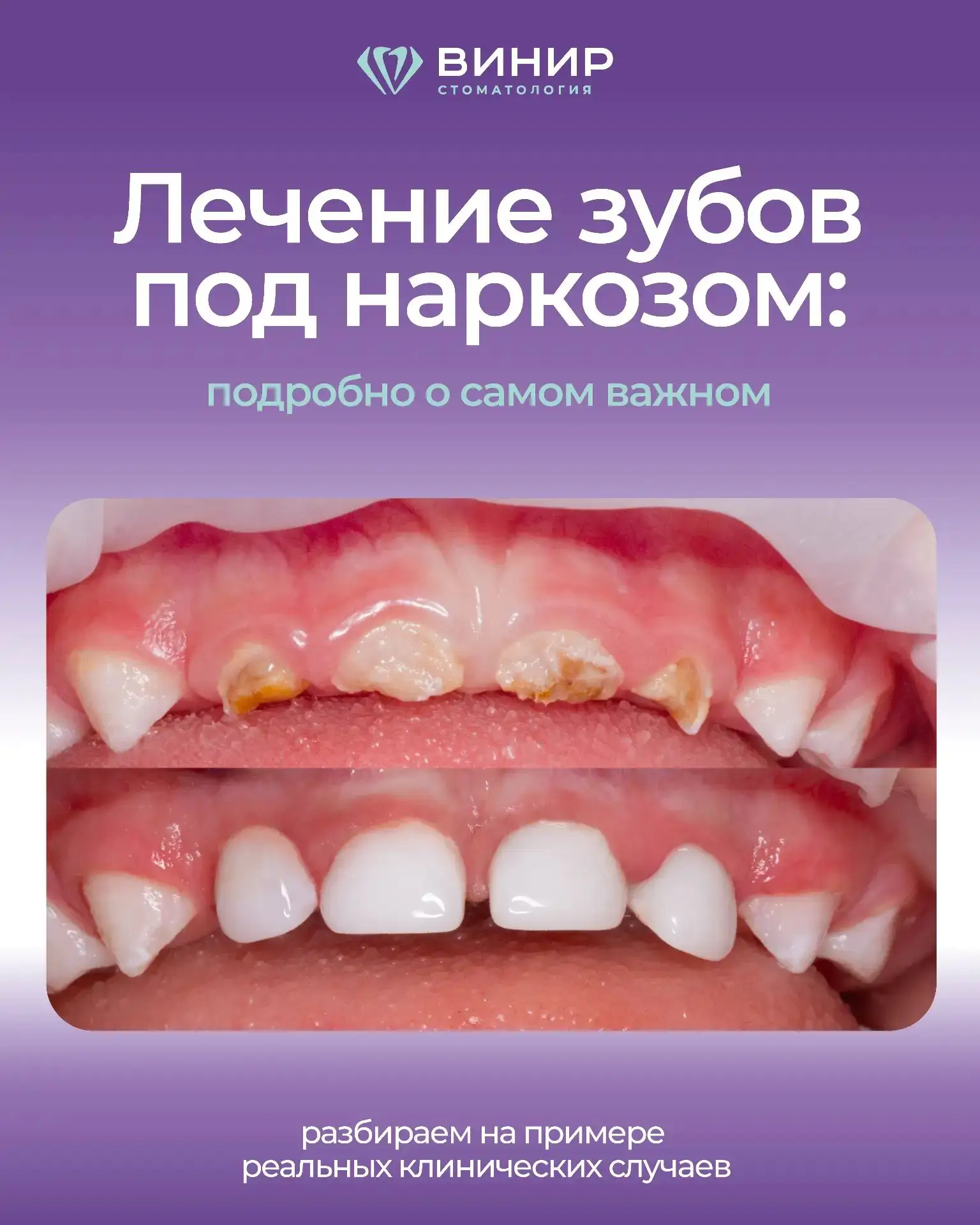 👶ЛЕЧЕНИЕ ДЕТЕЙ ПОД НАРКОЗОМ👶