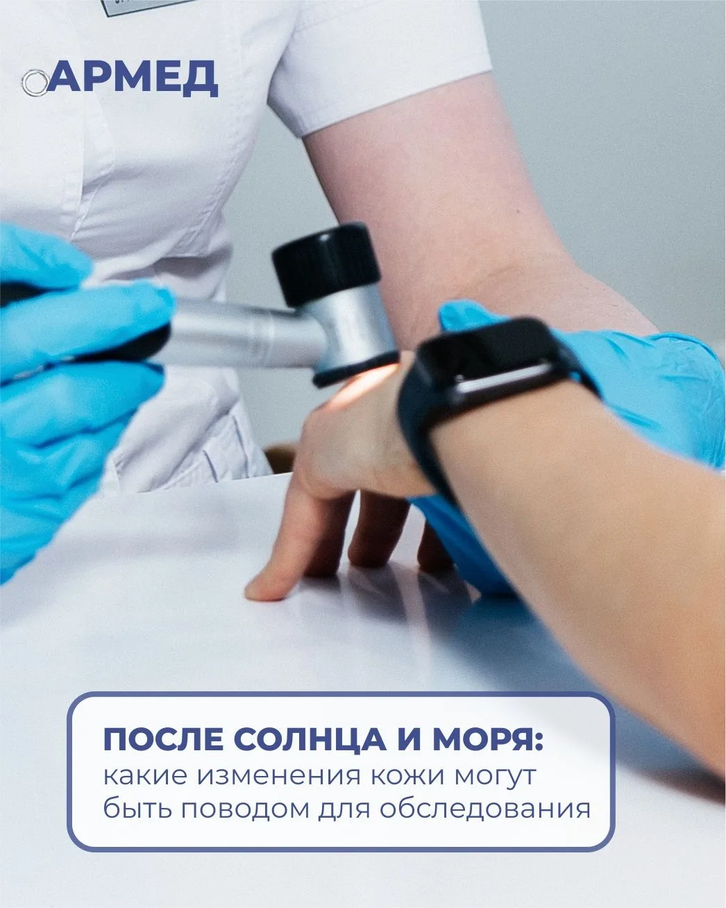 После солнца и моря: какие изменения кожи могут быть поводом для обследования?