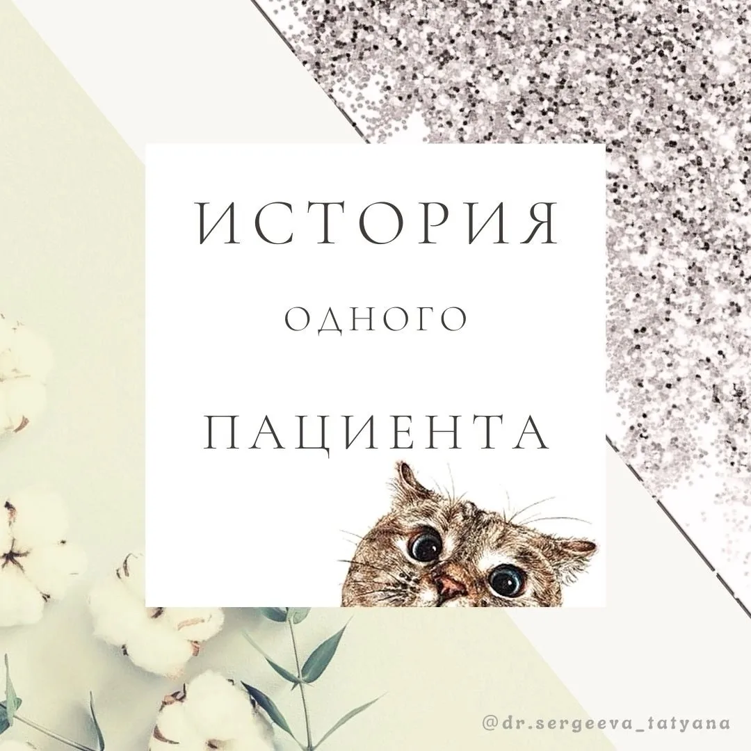 Приходит мужчина на прием. Косоглазие. Заболел остро.