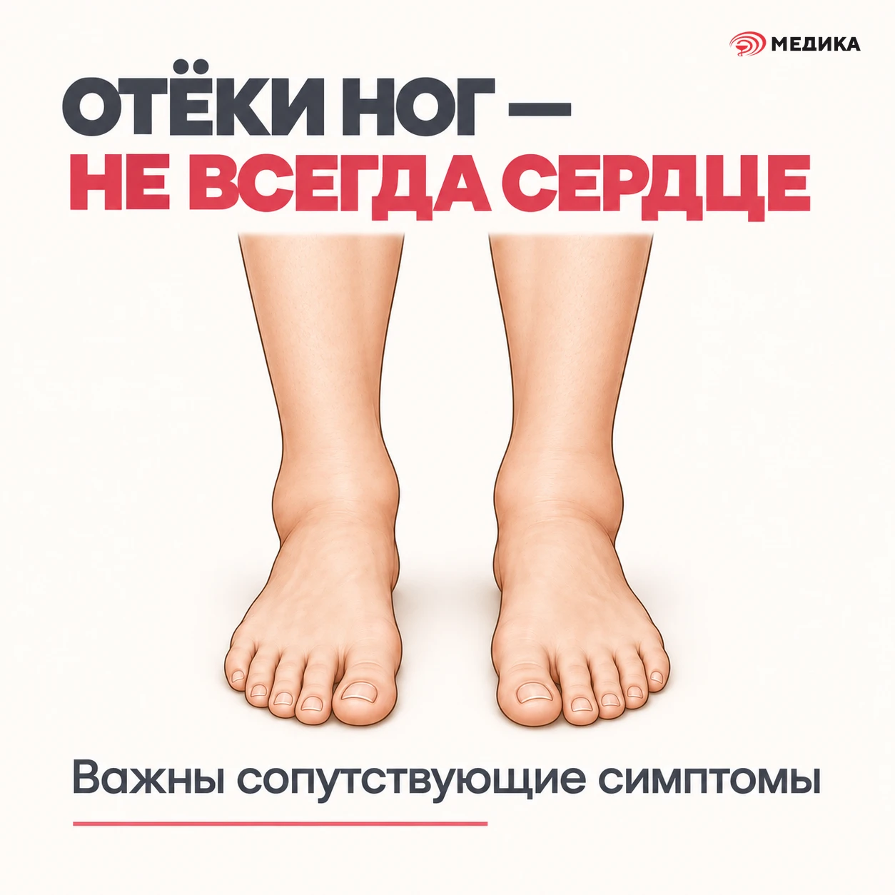 Отёки ног — это сердце?