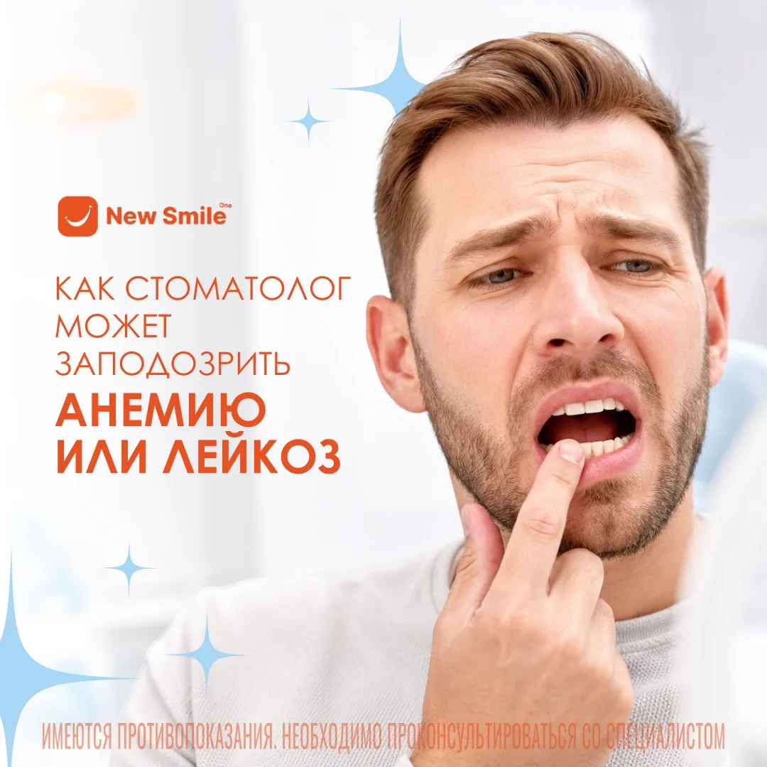 Как распознать анемию?