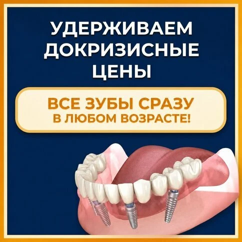 Несъёмный протез на 4-х имплантах за 1 день
