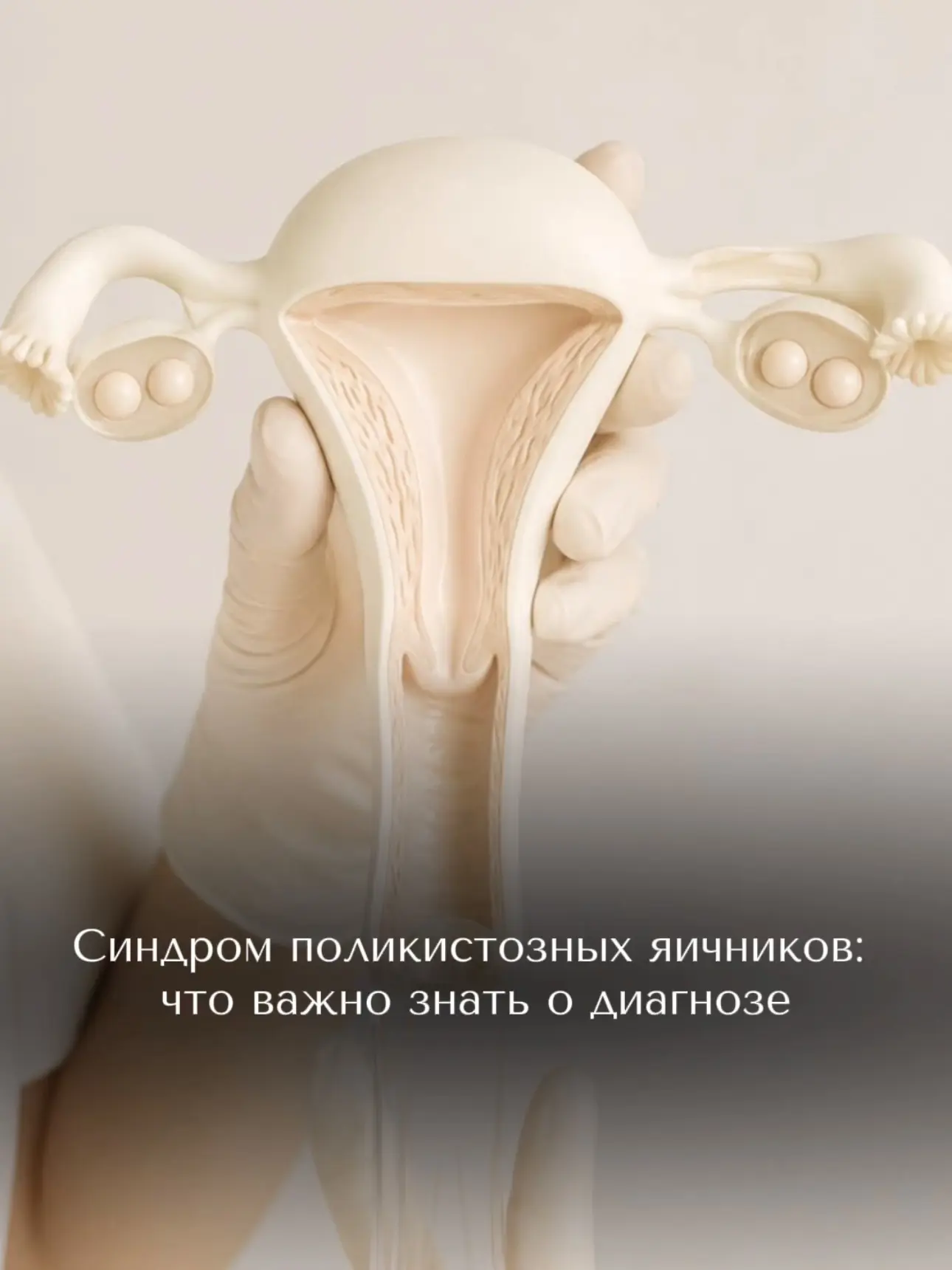 СПКЯ – это не только про нерегулярный цикл и сложности с наступлением беременности