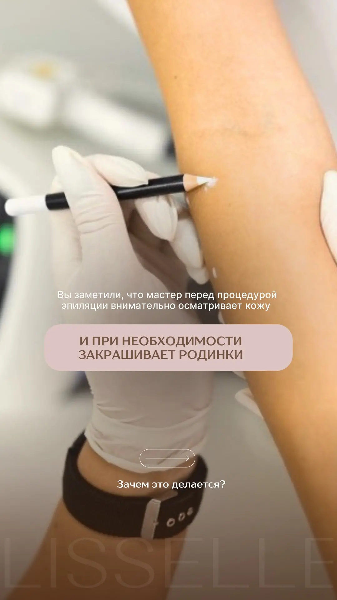 Вы заметили, что мастер перед процедурой эпиляции внимательно осматривает кожу и при не...
