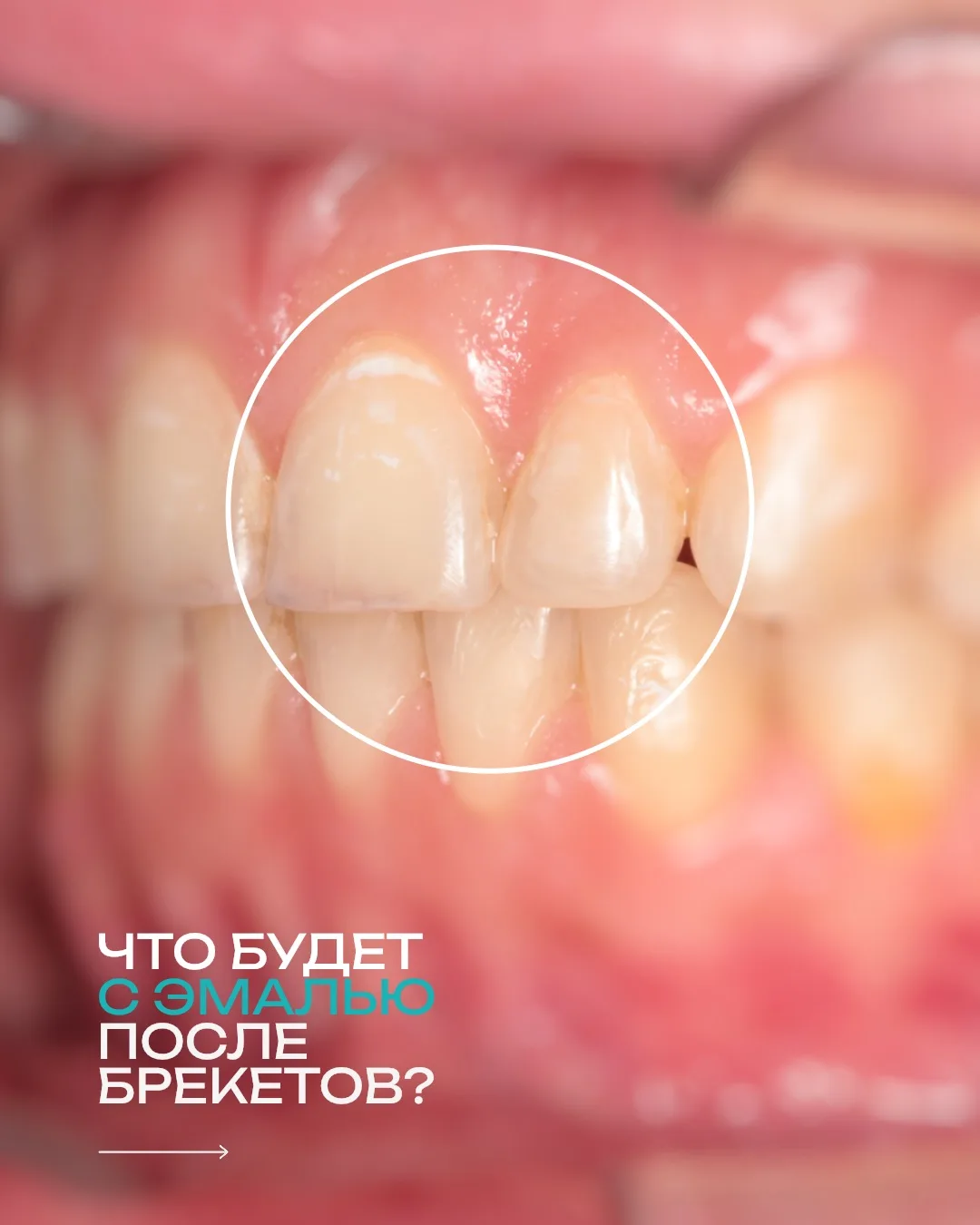 От того, насколько ответственно вы будете подходить к гигиене, зависит внешний вид и зд...