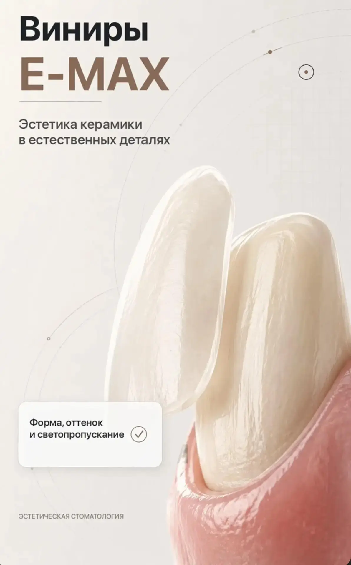 🦷 Что такое виниры E-MAX?