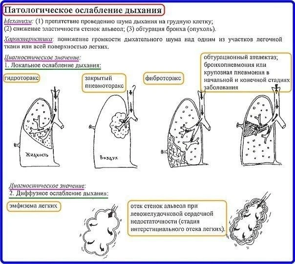 Аускультация легких