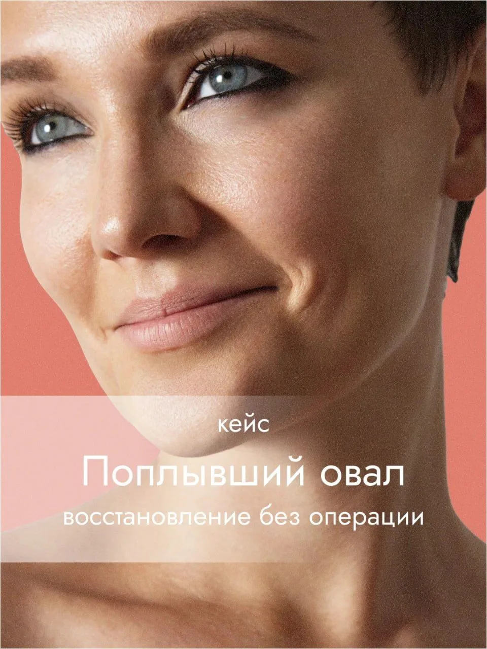 🔹Пациентка, 52 года. Запрос: овал лица потерял чёткость, нижняя треть отяжелела, появи...