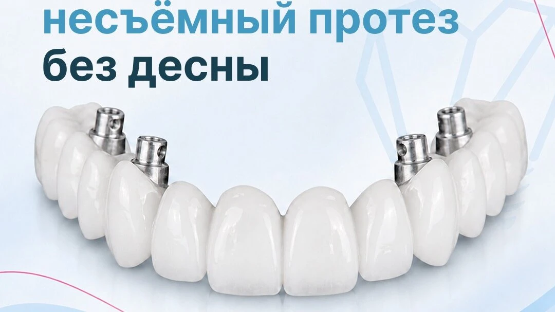 Новый метод имплантации зубов — без искусственной десны!