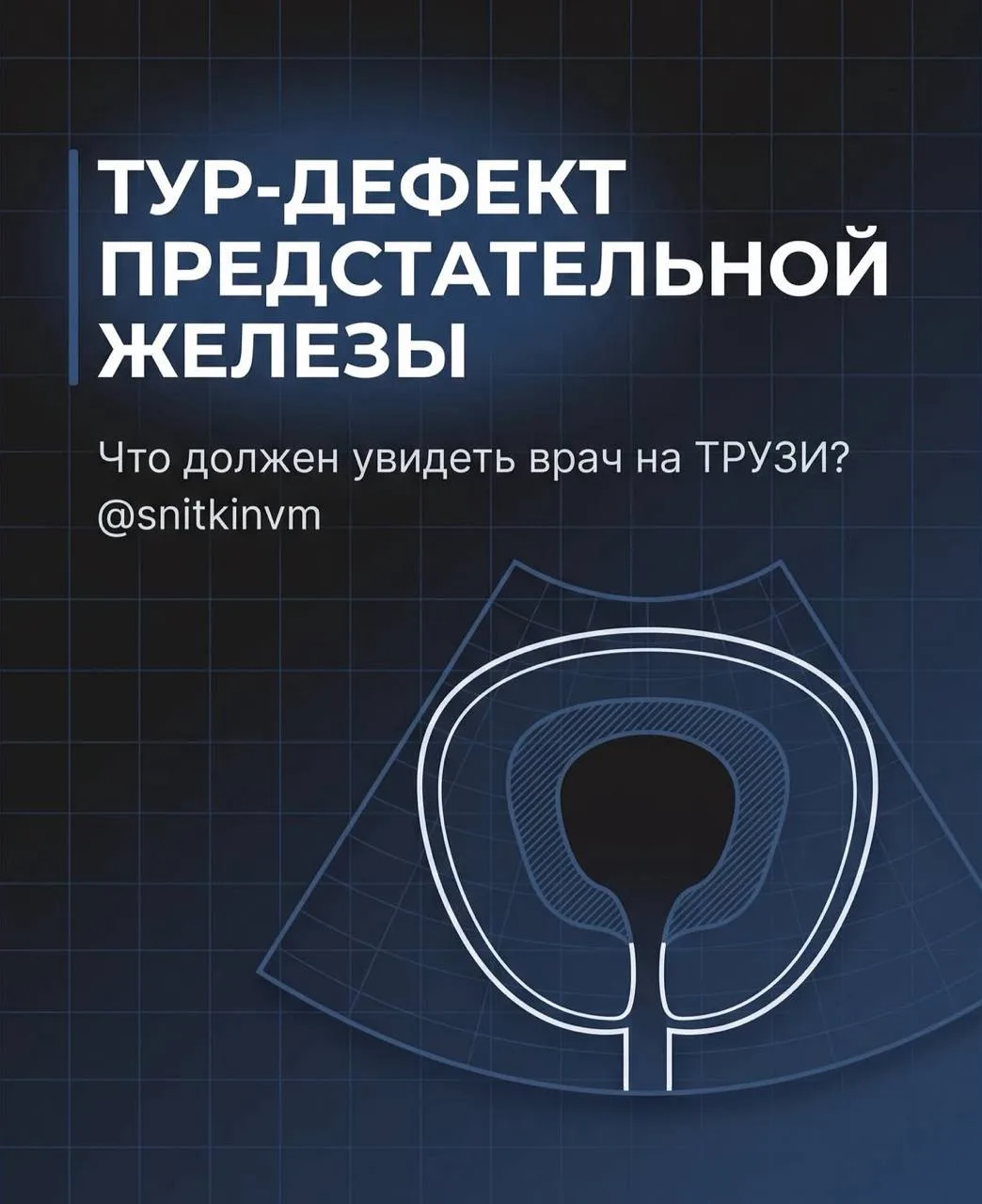 🔎ТУР-дефект предстательной железы
