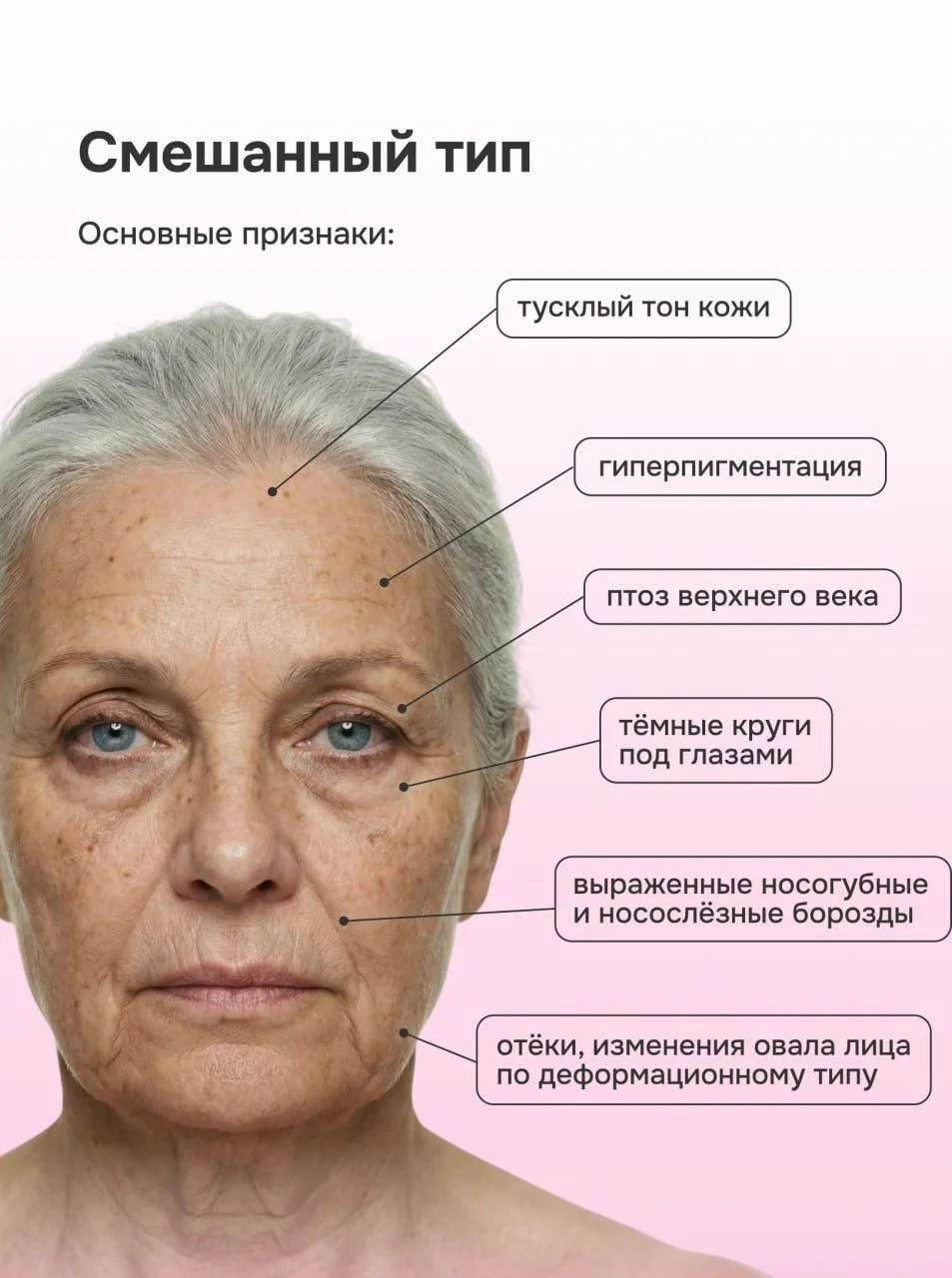 Как подобрать anti-age уход по типу старения?  Остановить время мы не можем, зато вполне способны до